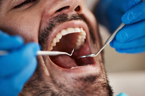 Best Urgent Tooth Repair  in Gambier, OH