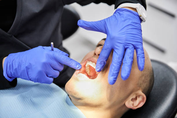 Best Emergency Dental Services Near Me  in Gambier, OH